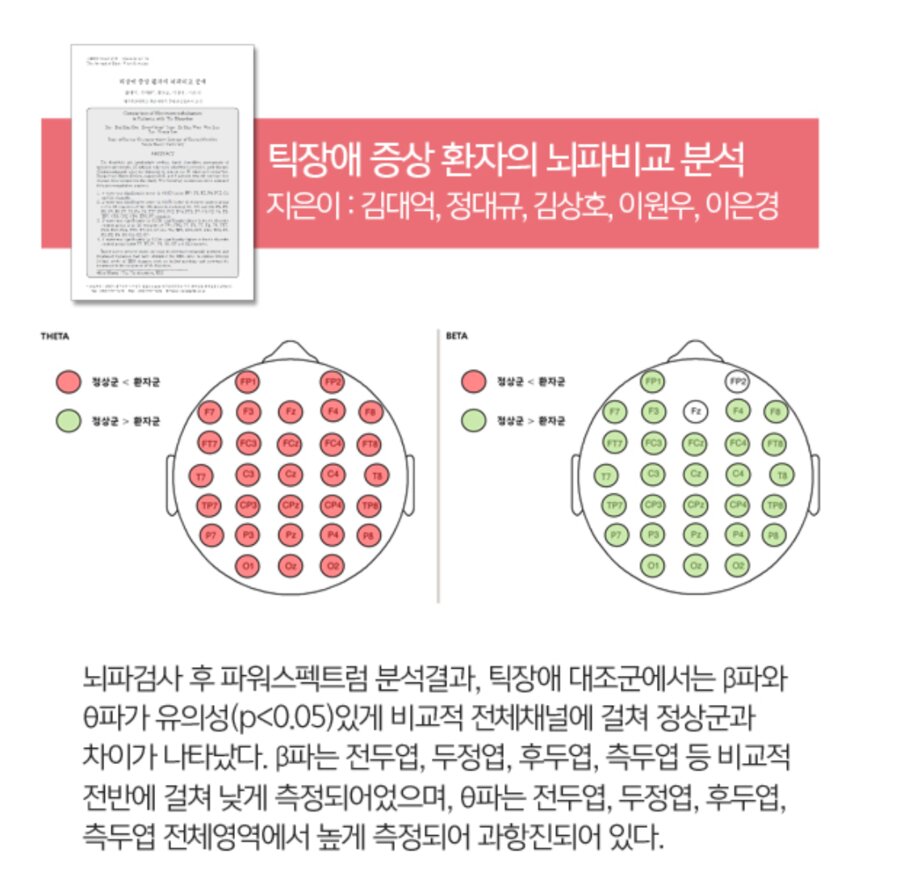 틱장애 증상 환자의 뇌파비교 분석 연구자료