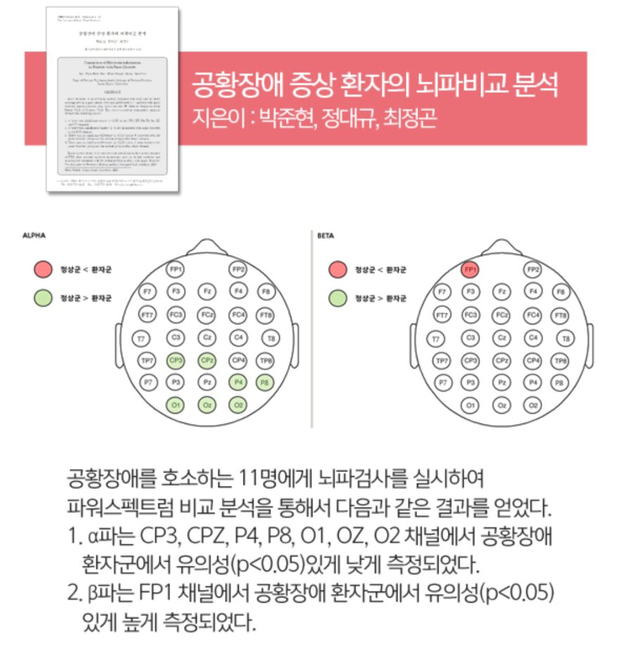 공황장애 증상 환자의 뇌파비교 분석 연구자료